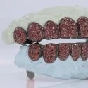 Iced Out 925 Silver VVS Moissanite Teeth Grillz Custom Diamond Tester Approved Grillz