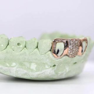Iced Out 925 Silver VVS Moissanite Teeth Grillz Custom Diamond Tester Approved Grillz