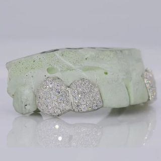 Iced Out 925 Silver VVS Moissanite Teeth Grillz Custom Diamond Tester Approved Grillz