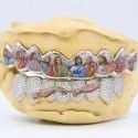 Iced Out 925 Silver VVS Moissanite Teeth Grillz Custom Diamond Tester Approved Grillz