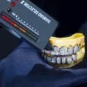 Diamond GriIlz On Teeth