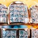 Diamond GriIlz On Teeth