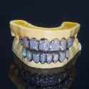 Diamond GriIlz On Teeth