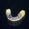 Diamond GriIlz On Teeth