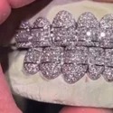 Iced Out 925 Silver VVS Moissanite Teeth Grillz Custom Diamond Tester Approved Grillz