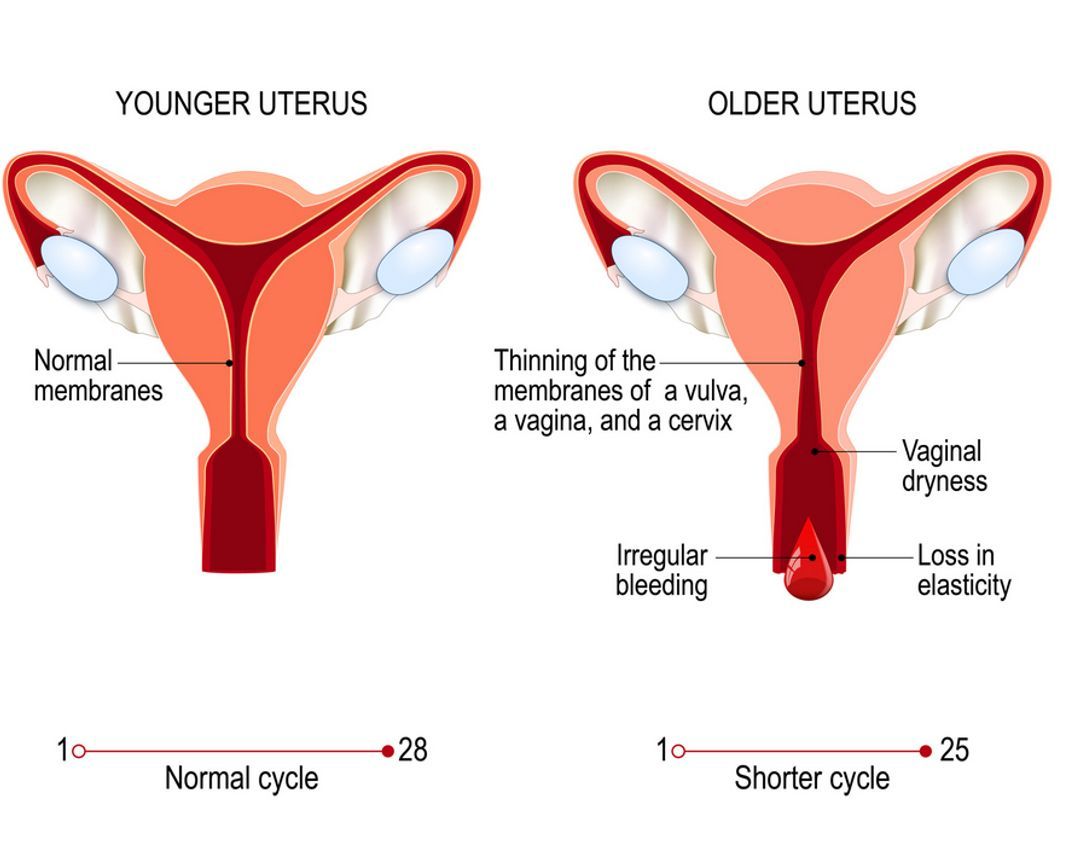 Diagrams of a younger and older uterus with labels explaining the main differences.