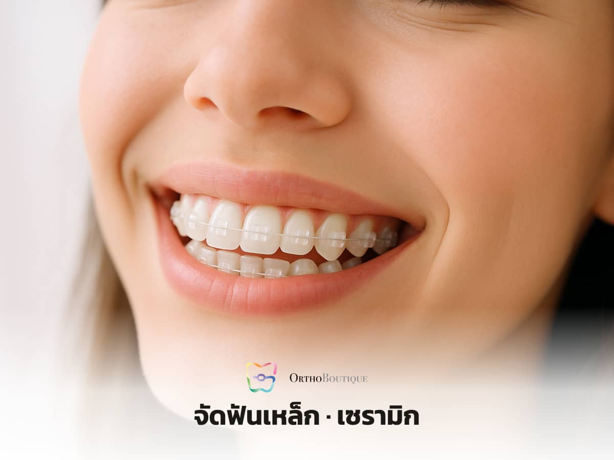 จัดฟันกับหมอเฉพาะทาง ใจกลางซิดนีย์ — OrthoBoutique
