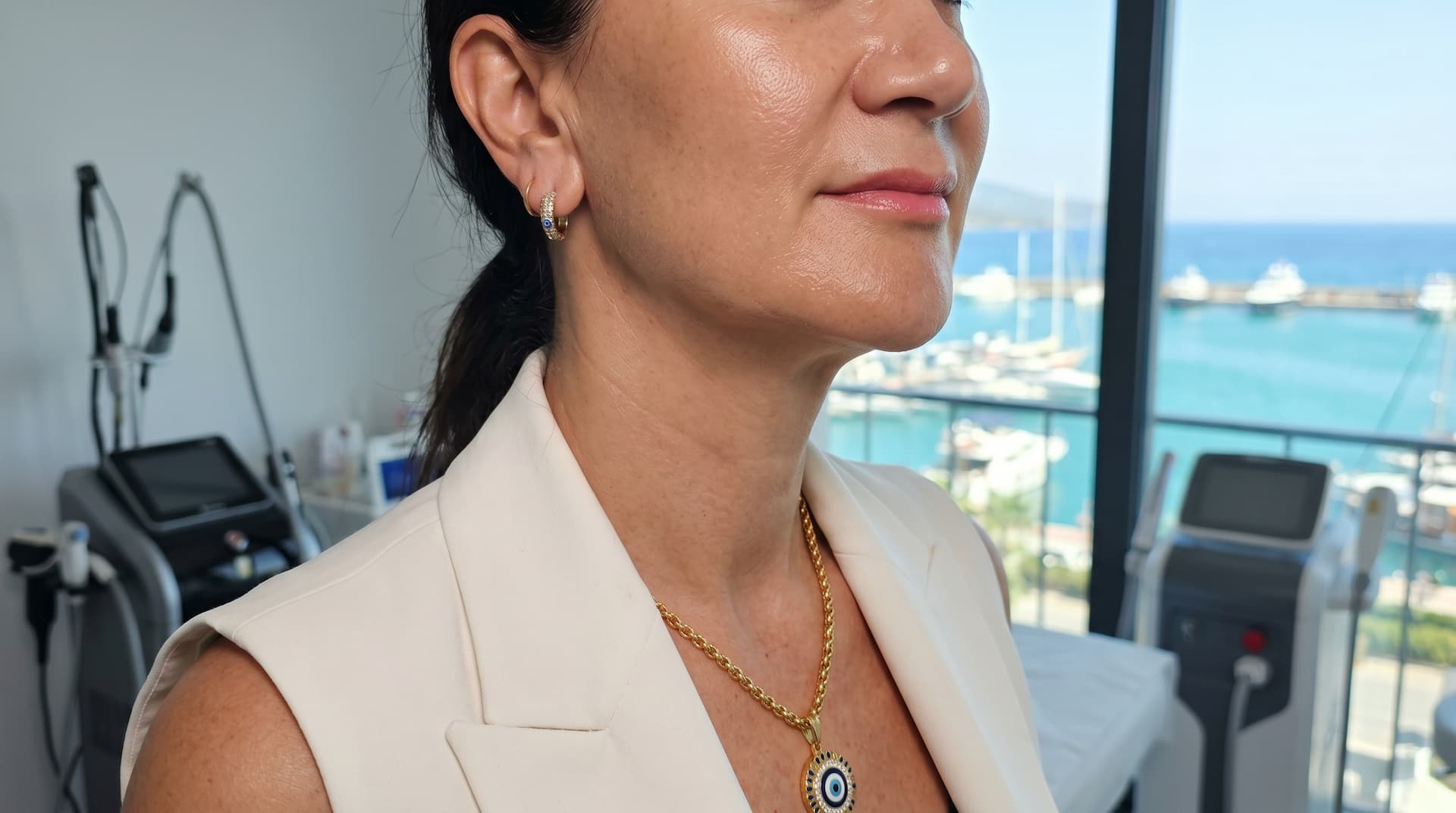 Fethiye'de Boyun Gençleştirme – Pürüzsüz ve Genç Bir Görünüm