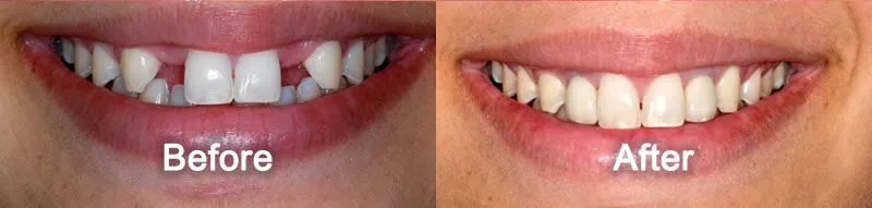 25-1790750911193