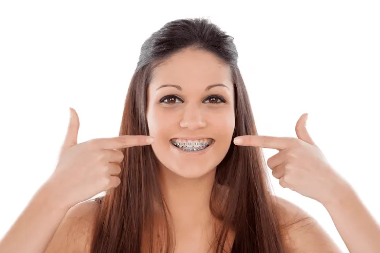 Dental Braces Maintenance: Care Tips & Tricks feature image