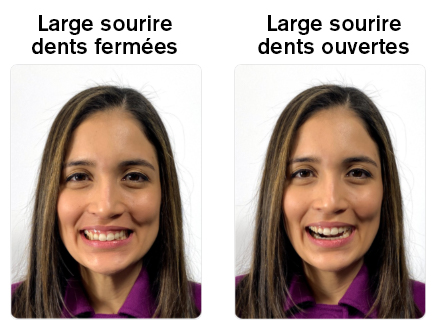 Photos du visage avec large sourire à dents fermées et à dents ouvertes