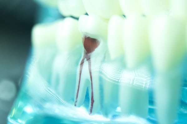woman missing tooth