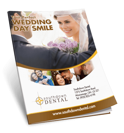 Wedding Day Smile Guide