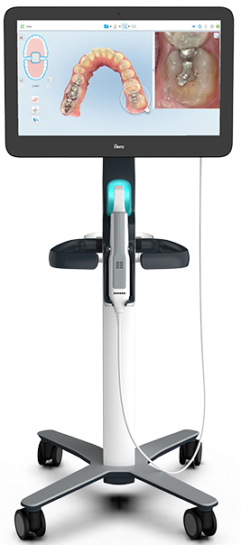 Itero scanner