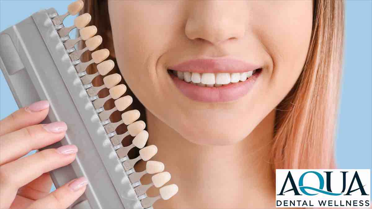 A woman holding up a set of dental veneers.