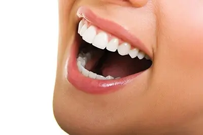 women smiling wide with nice white teeth