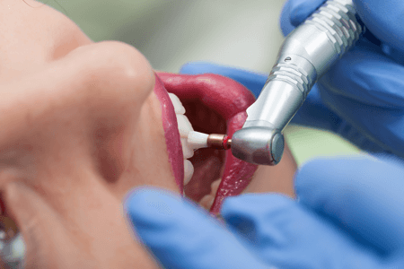 dentist using dental equipment on women patient 