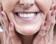 older women smiling with nice teeth