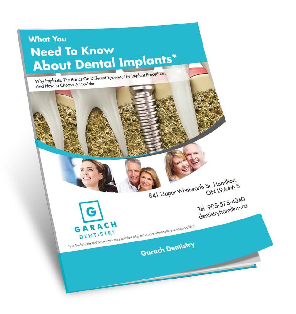 Dental Implants Guide