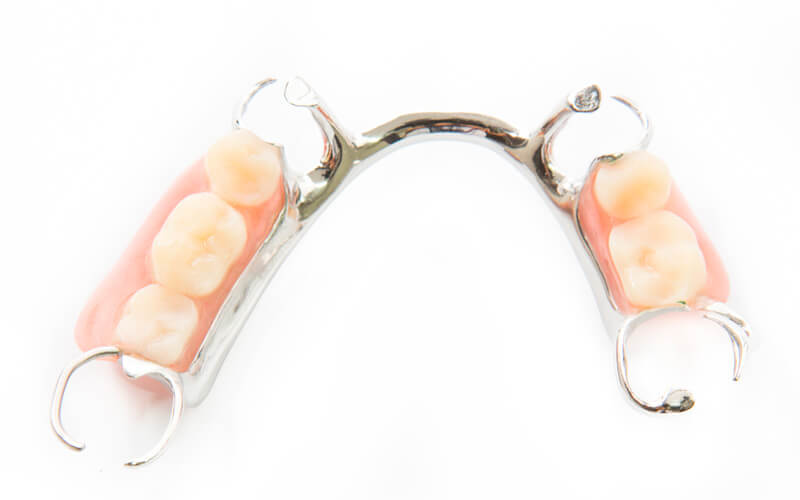 Partial dentures