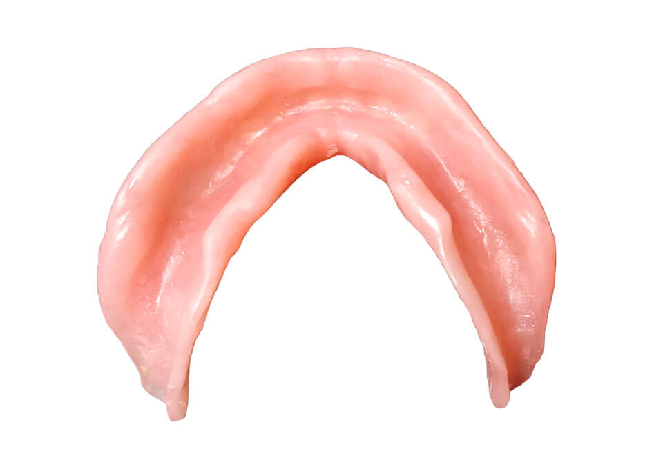 Suction dentures - bottom mold