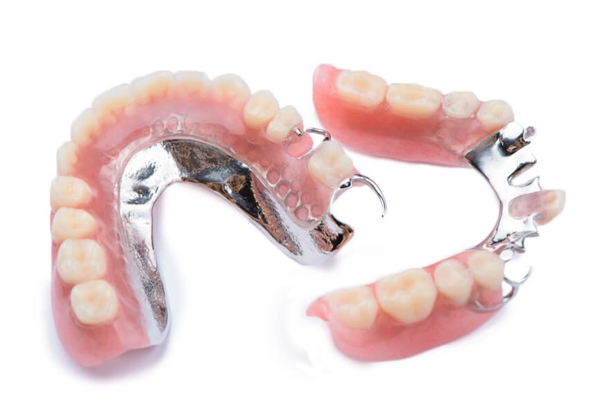 Partial dentures