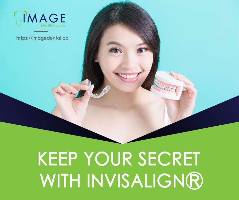 blog image: keep your secret with invisalign