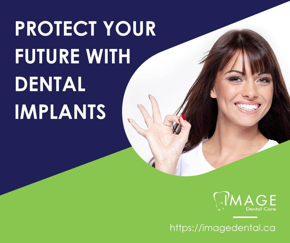 blog image: protect your future with dental implants