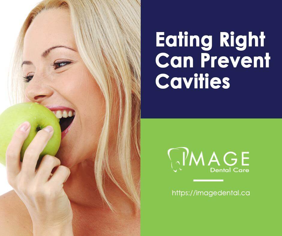 blog image: Eating right can prevent cavities