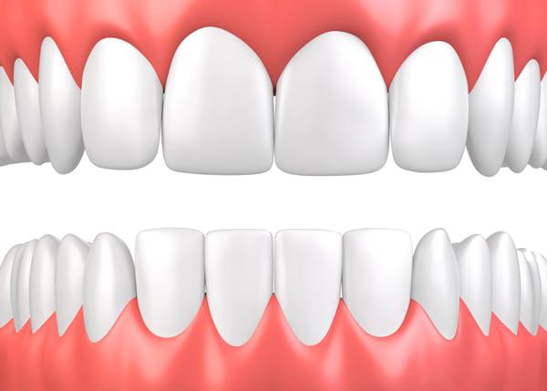 illustration of gums for periodontist page