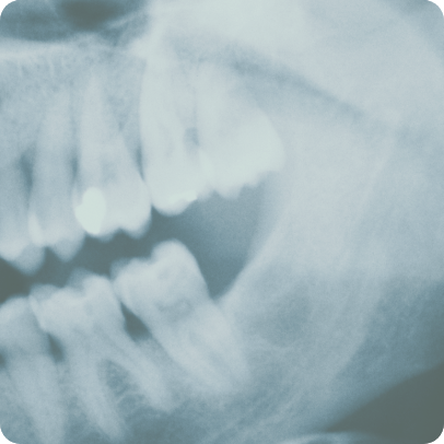 Dental X-rays