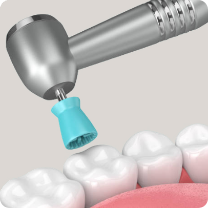 Tooth polishing