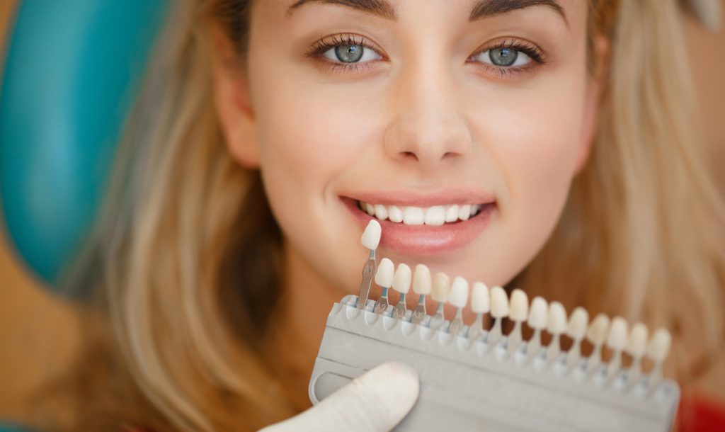 A dentist holding a shade guide for teeth whitening up to a woman's teeth.