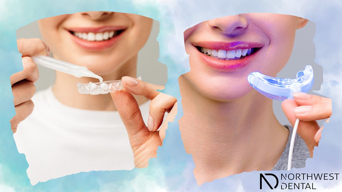 A patient using DIY teeth whitening methods on the left and professional whitening on the right.