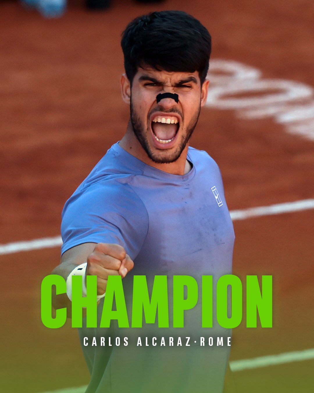 CARLOZ ALCARAZ IS CHAMPION IN ROME