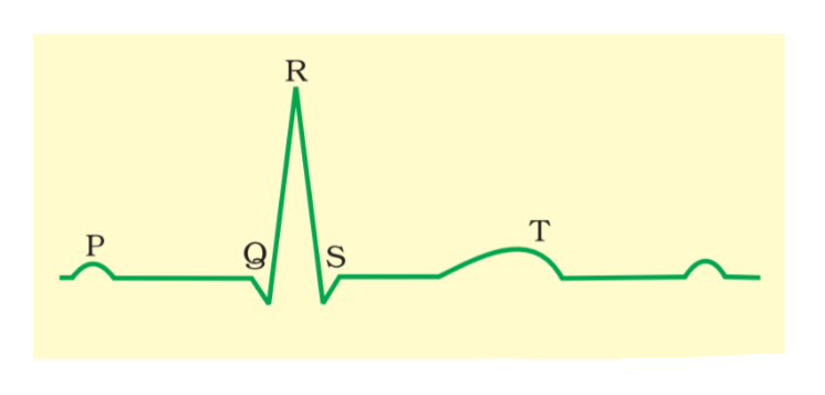 NEET question diagram