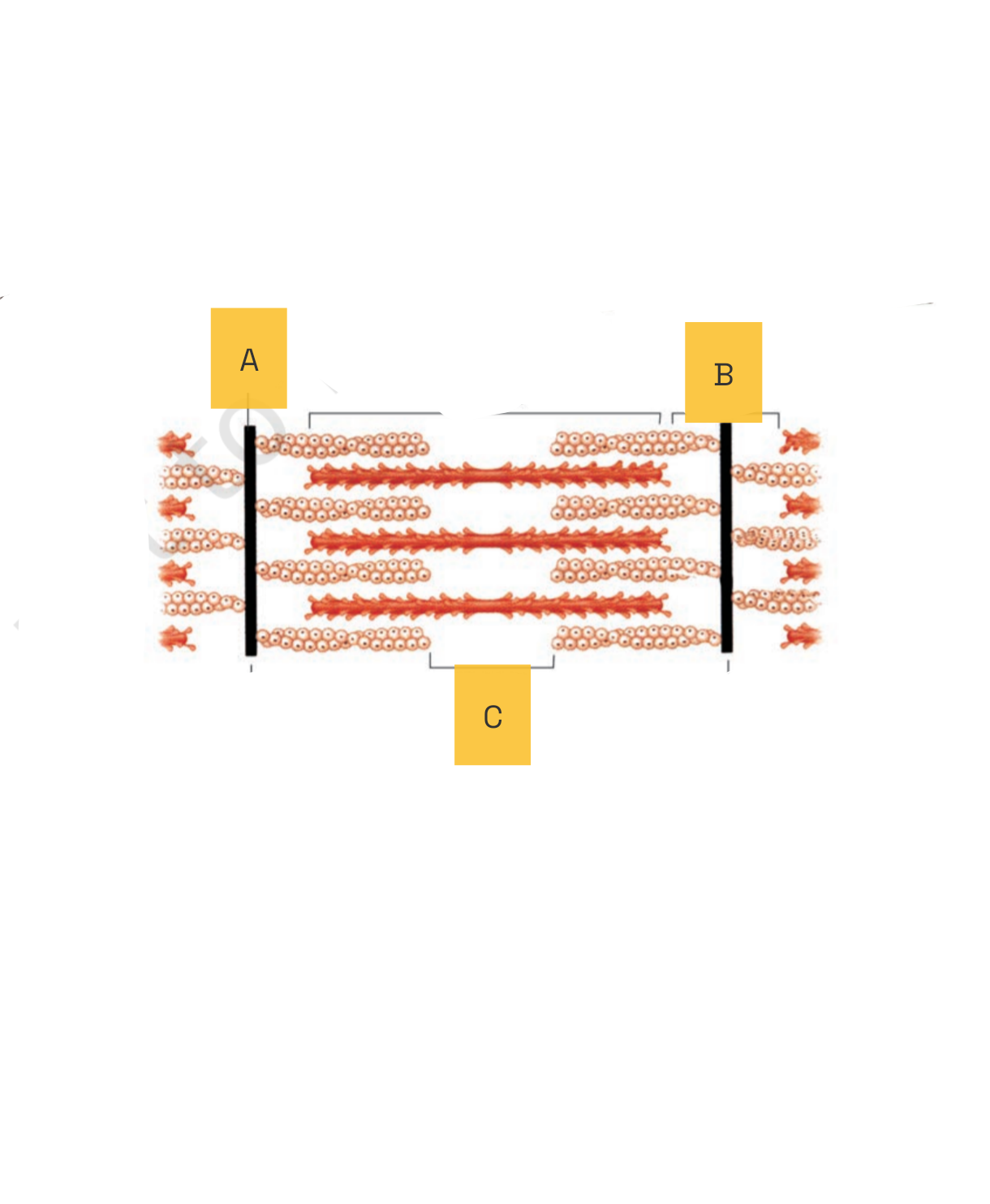 NEET question diagram