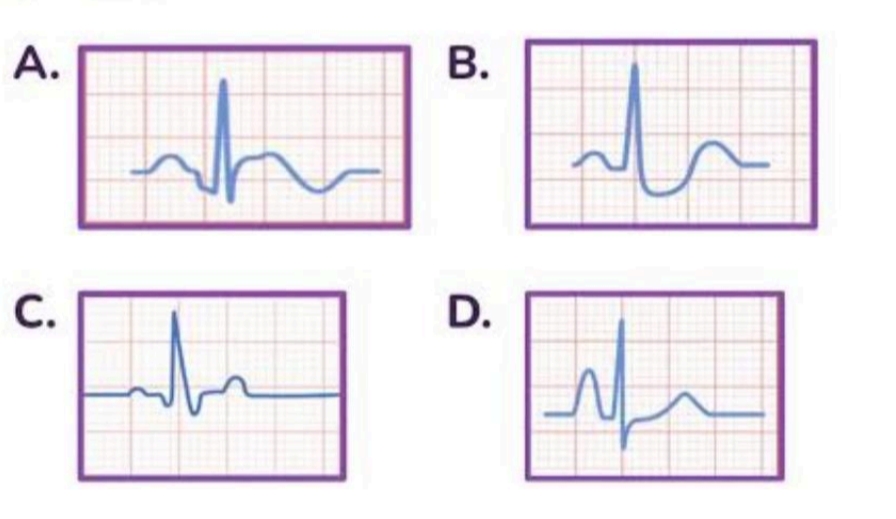 NEET question diagram