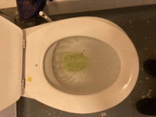 Dye testing carried out in Chelmsford to trace the source of multiple toilet blockages.