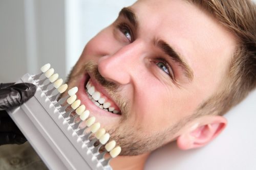 A man having his teeth colour matched for Veneers.