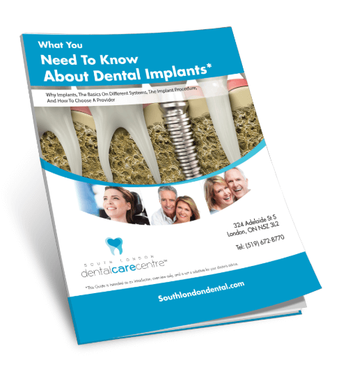 Dental implants patient guide