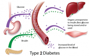 Diagram outlining Type 2 diabetes.