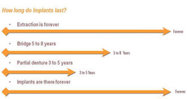 How long do implants last?
