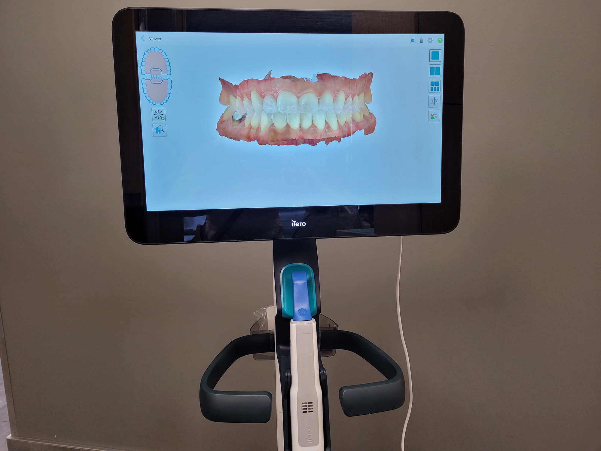 The display of an iTero element scanner.