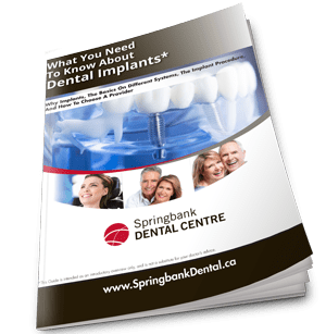 Patient Guide on Dental Implants
