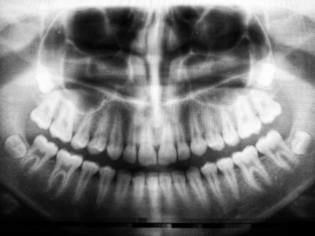 a dental xray