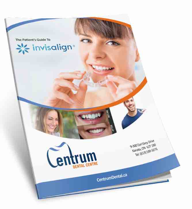 our free invisalign guide