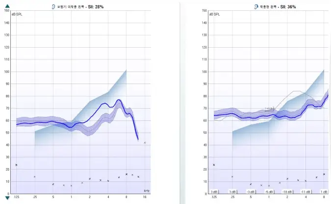 다차원 청력 분석