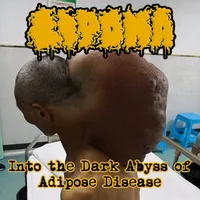 Into the Dark Abyss of Adipose Disease - Lipoma