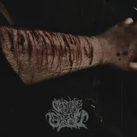 Nobody Cares Why You Did It - Overdose to Sleep
